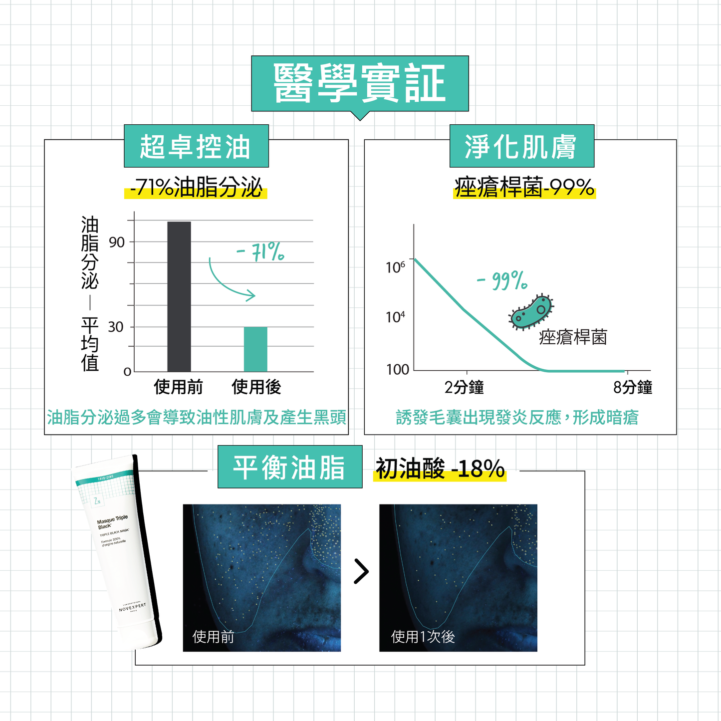 活性炭深層潔淨磨砂泥膜 Triple Black Mask