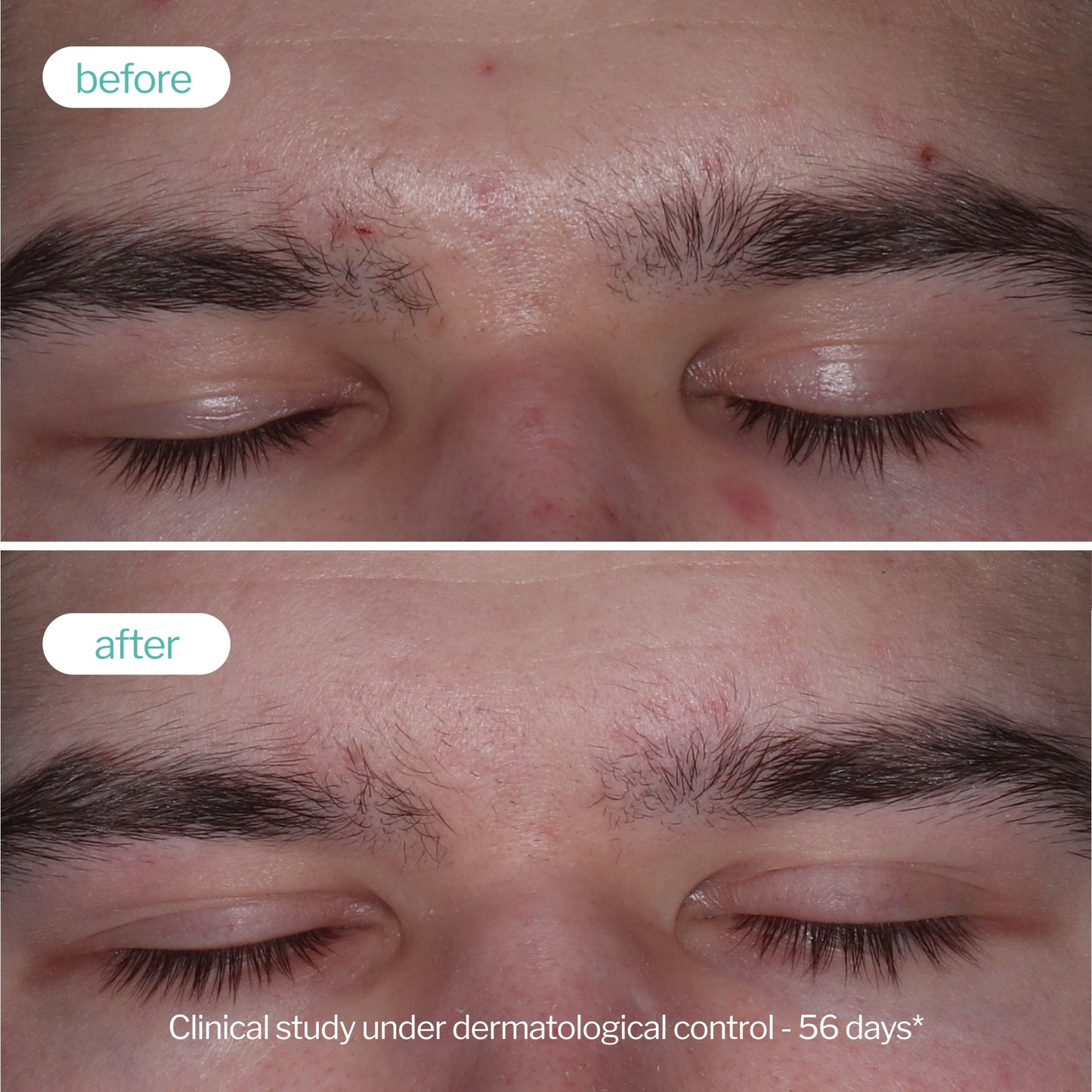 三重活性鋅導入精華 Trio-Zinc Booster Serum